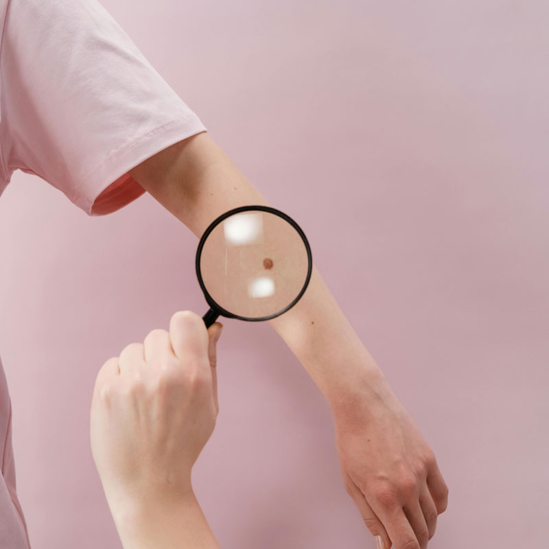 DermNet 為全球性皮膚科及皮膚病臨床資源網站