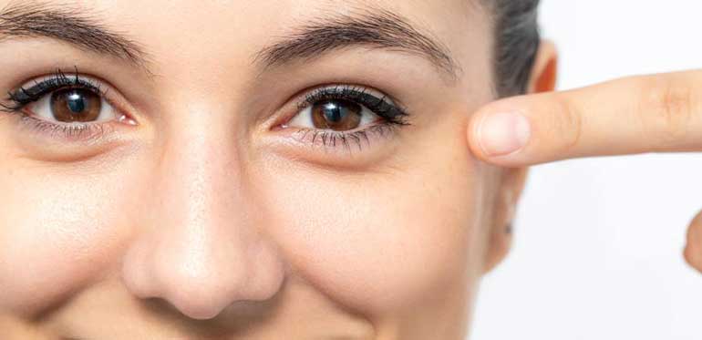 楊浩康(Yeung Ho Hong)醫生講解肉毒桿菌毒素改善魚尾紋