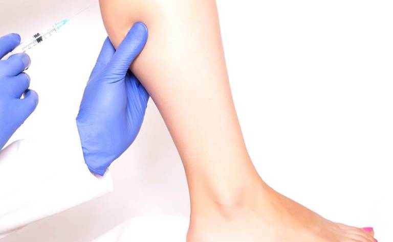 肉毒桿菌毒素改善小腿肌肉肥大 - 楊浩康醫生