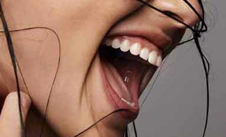 改善露齦笑/笑齦 - 肉毒桿菌毒素注射 - 楊浩康醫生